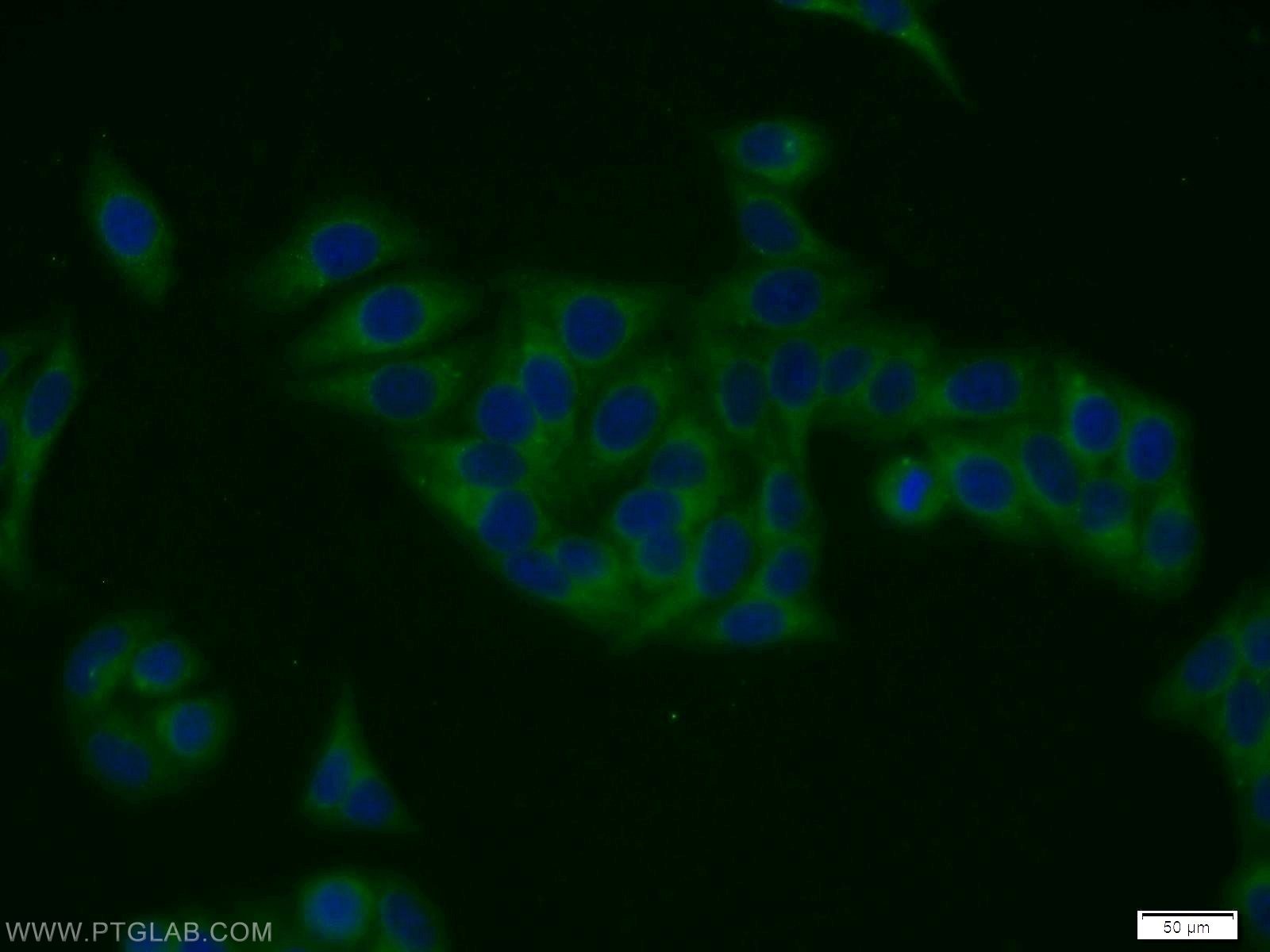 Immunofluorescence (IF) / fluorescent staining of HepG2 cells using TPCN1 Polyclonal antibody (23758-1-AP)