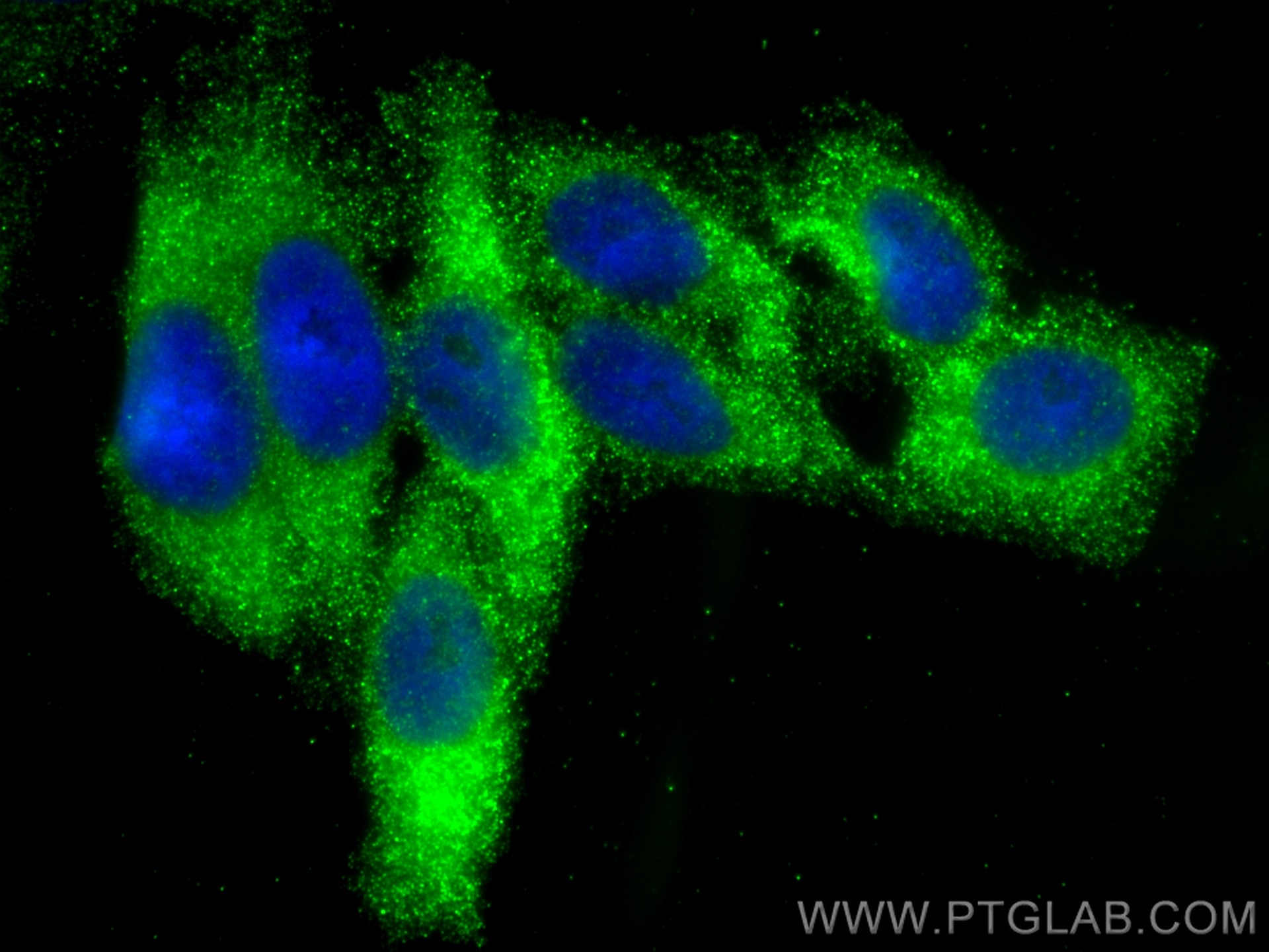 Immunofluorescence (IF) / fluorescent staining of HepG2 cells using TPC1 Polyclonal antibody (23758-1-AP)