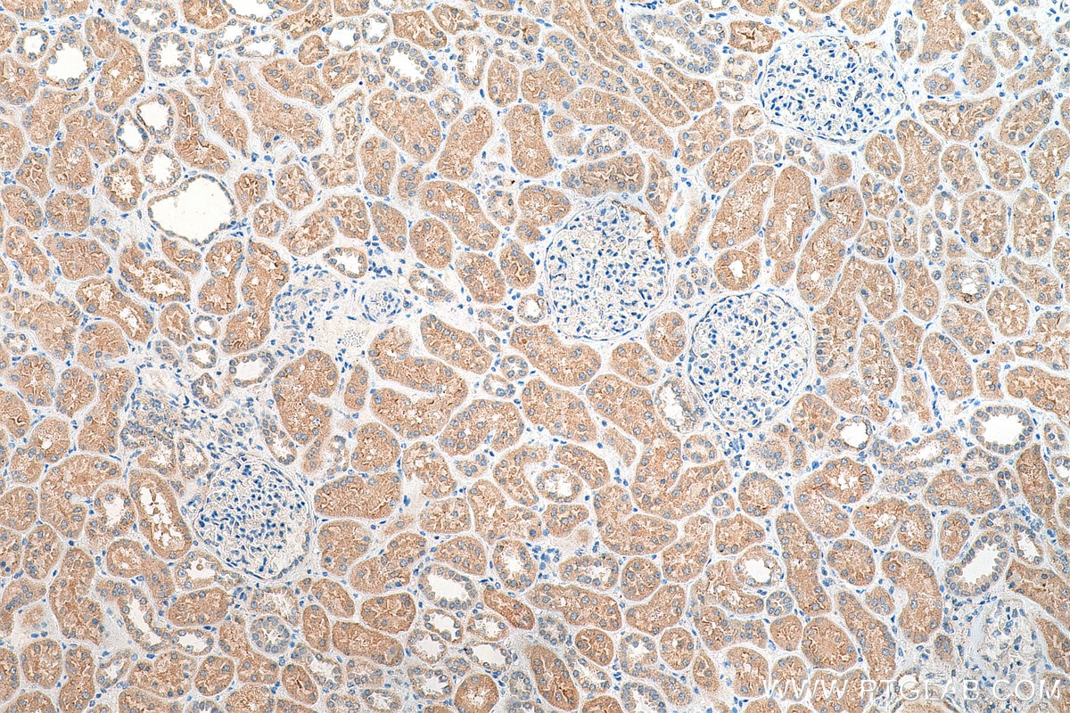 Immunohistochemistry (IHC) staining of human kidney tissue using TPCN1 Polyclonal antibody (23758-1-AP)
