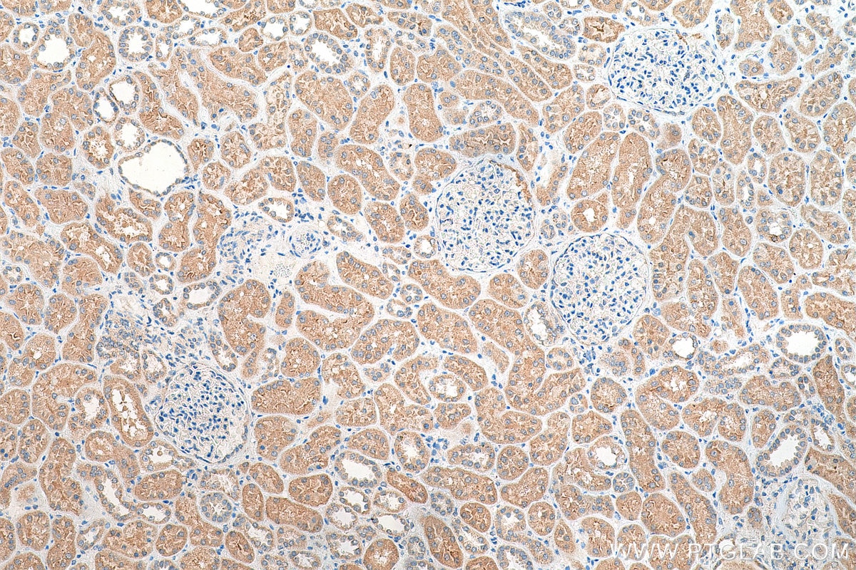 Immunohistochemistry (IHC) staining of human kidney tissue using TPCN1 Polyclonal antibody (23758-1-AP)