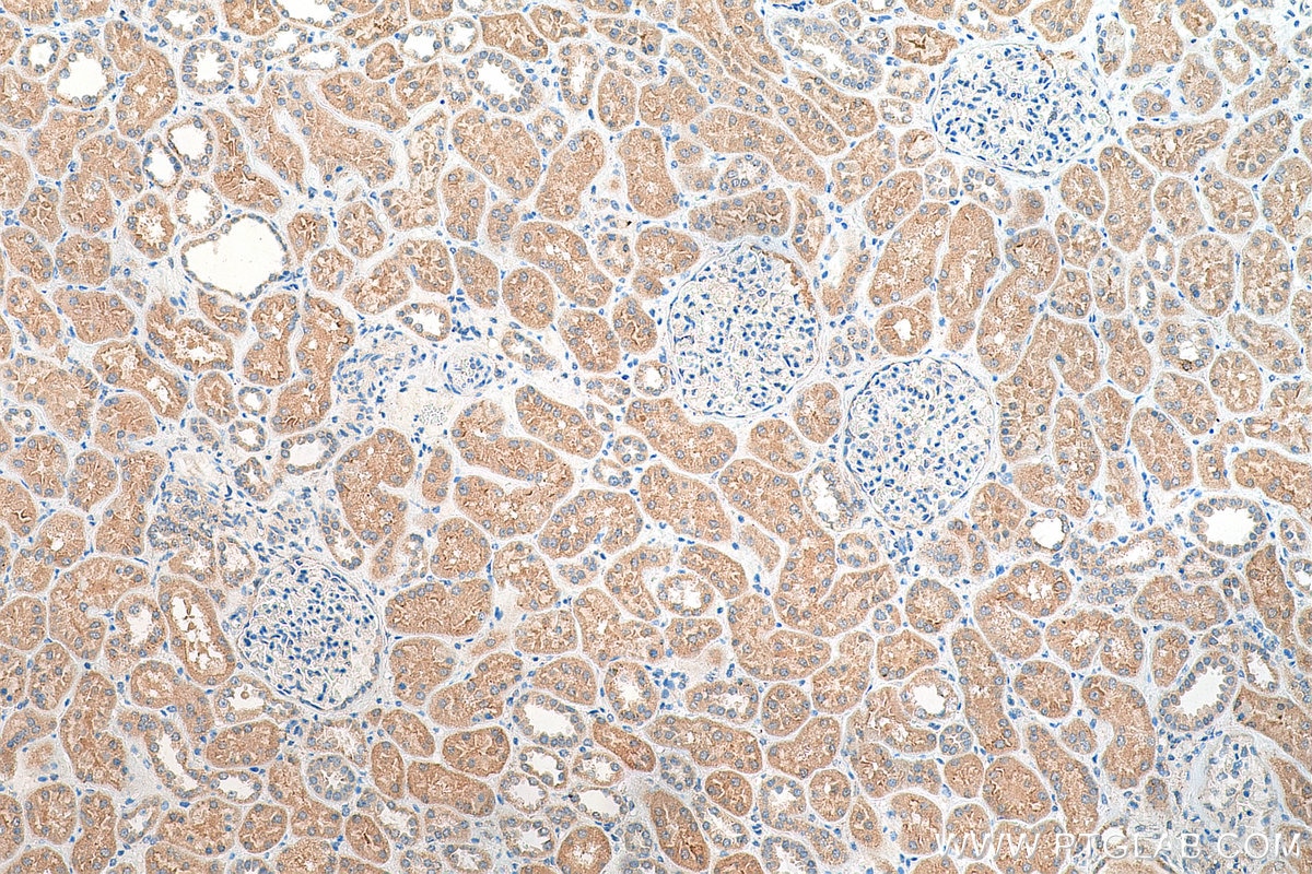 IHC staining of human kidney using 23758-1-AP