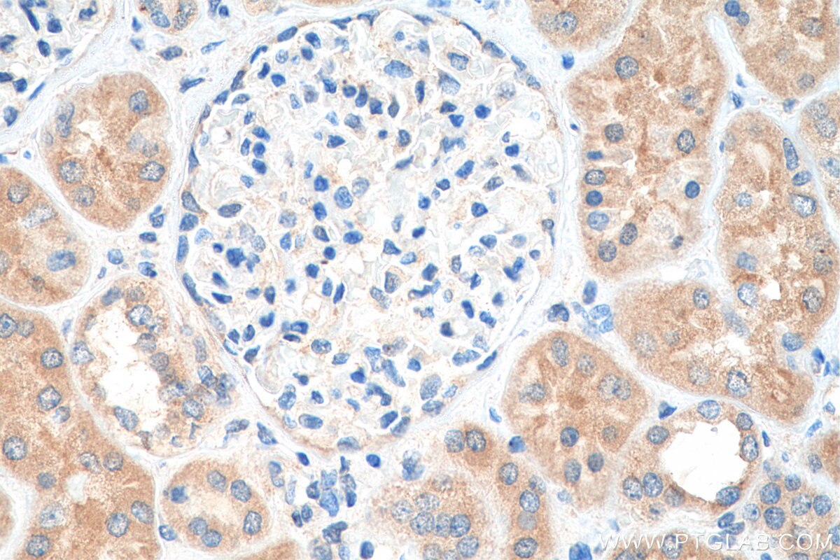 Immunohistochemistry (IHC) staining of human kidney tissue using TPCN1 Polyclonal antibody (23758-1-AP)