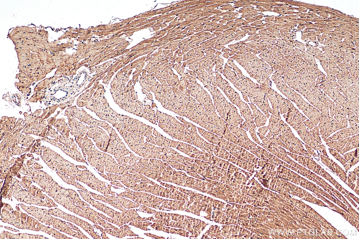 Immunohistochemistry (IHC) staining of mouse heart tissue using TPC1 Polyclonal antibody (23758-1-AP)