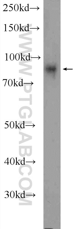 Western Blot (WB) analysis of mouse heart tissue using TPCN1 Polyclonal antibody (23758-1-AP)