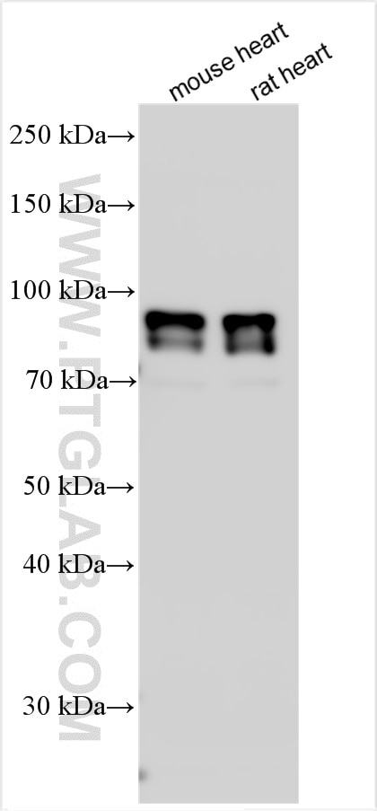 Western Blot (WB) analysis of various lysates using TPC1 Polyclonal antibody (23758-1-AP)
