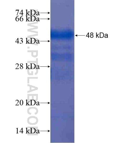 TPCN1 fusion protein Ag20607 SDS-PAGE