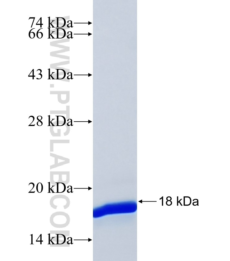 TPCN2 fusion protein Ag38994 SDS-PAGE