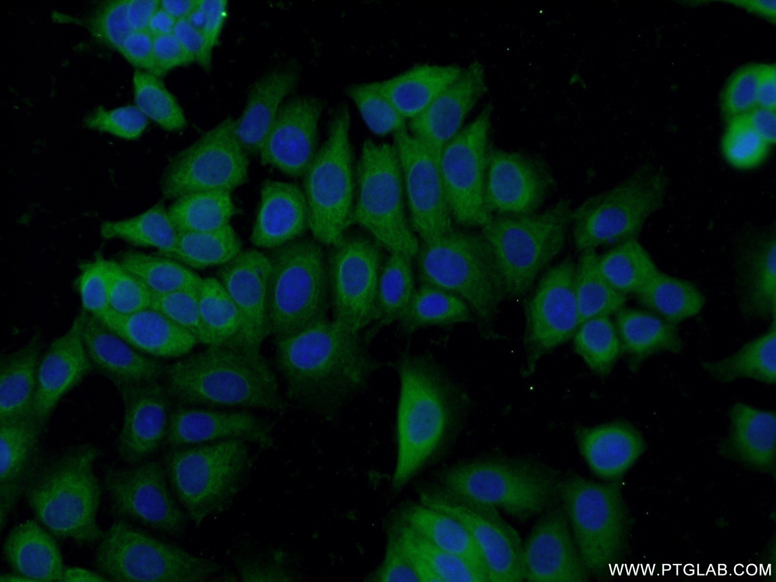 Immunofluorescence (IF) / fluorescent staining of MCF-7 cells using hD53; TPD52L1 Polyclonal antibody (14732-1-AP)