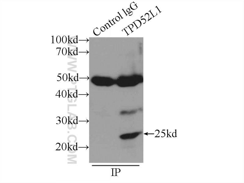 Immunoprecipitation (IP) experiment of MCF-7 cells using hD53; TPD52L1 Polyclonal antibody (14732-1-AP)