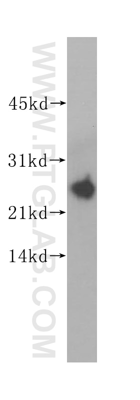Western Blot (WB) analysis of MCF-7 cells using hD53; TPD52L1 Polyclonal antibody (14732-1-AP)