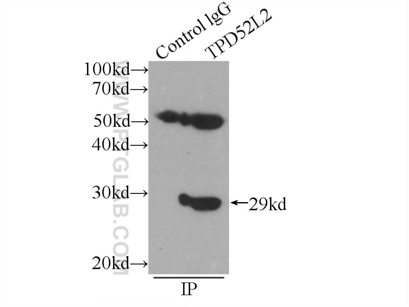 Immunoprecipitation (IP) experiment of HEK-293 cells using TPD52L2 Polyclonal antibody (11795-1-AP)