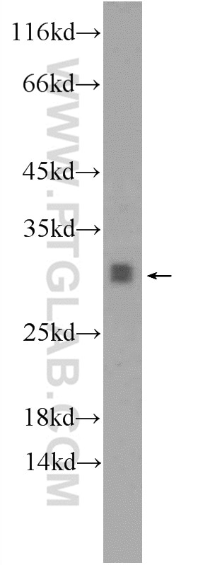Western Blot (WB) analysis of rat brain tissue using TPD52L2 Polyclonal antibody (11795-1-AP)