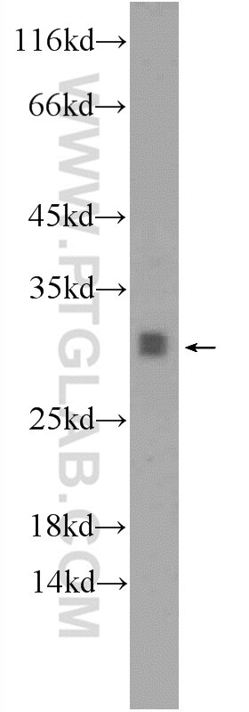 Western Blot (WB) analysis of rat brain tissue using TPD52L2 Polyclonal antibody (11795-1-AP)