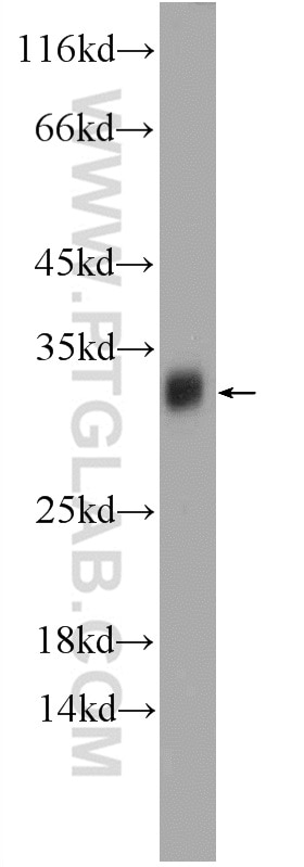 Western Blot (WB) analysis of mouse brain tissue using TPD52L2 Polyclonal antibody (11795-1-AP)