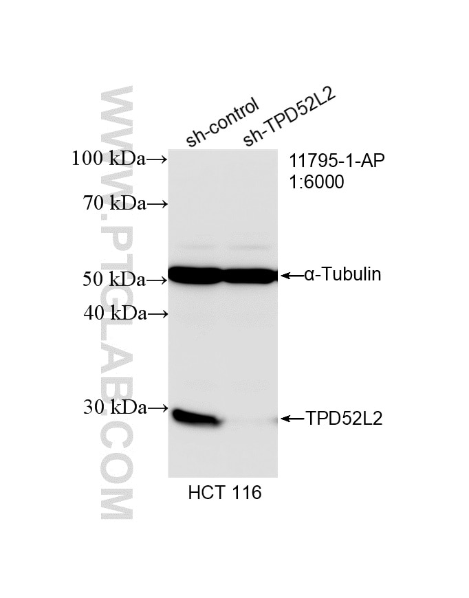Western Blot (WB) analysis of HCT 116 cells using TPD52L2 Polyclonal antibody (11795-1-AP)