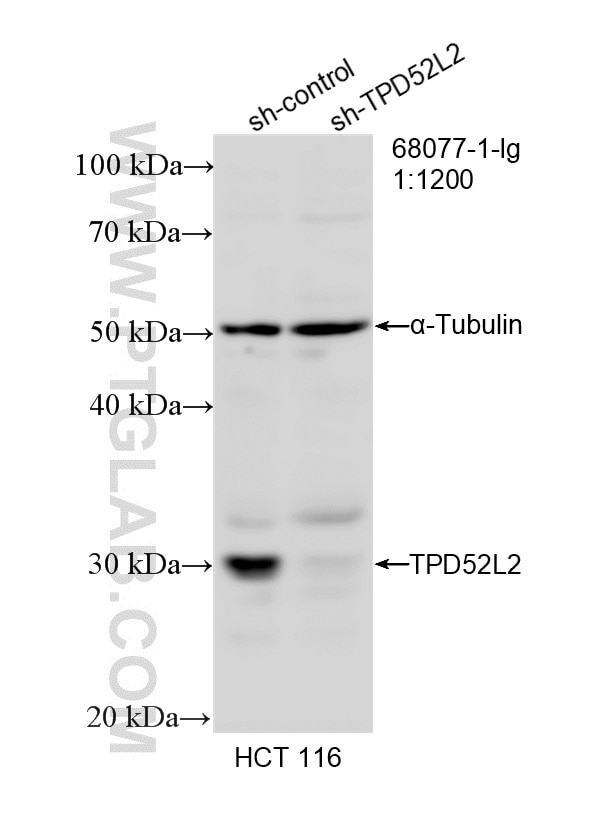 Western Blot (WB) analysis of HCT 116 cells using TPD52L2 Monoclonal antibody (68077-1-Ig)
