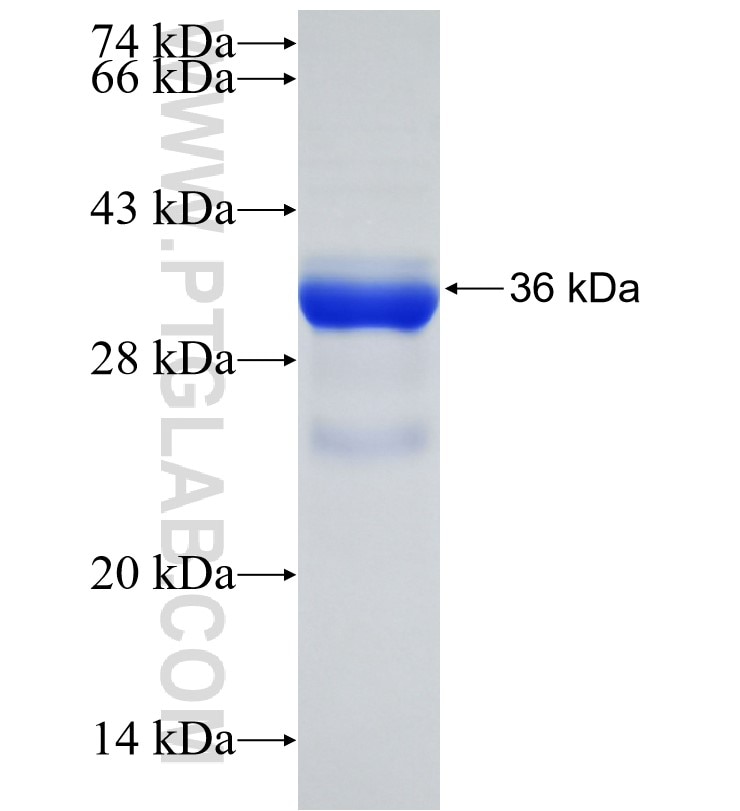 TPD52L2 fusion protein Ag30863 SDS-PAGE