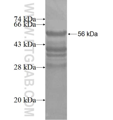 TPD52L2 fusion protein Ag2364 SDS-PAGE
