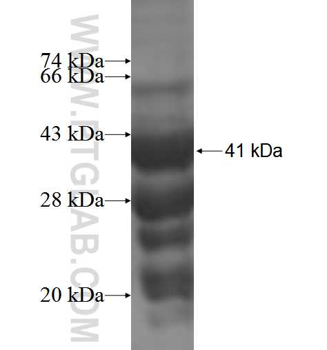TPD52L3 fusion protein Ag5101 SDS-PAGE