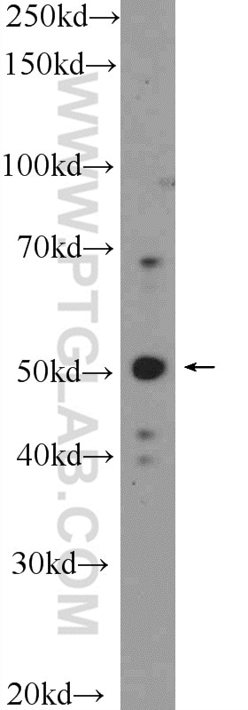 Western Blot (WB) analysis of SH-SY5Y cells using TPH1 Polyclonal antibody (20879-1-AP)