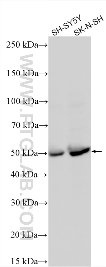 Western Blot (WB) analysis of various lysates using TPH1 Polyclonal antibody (29904-1-AP)