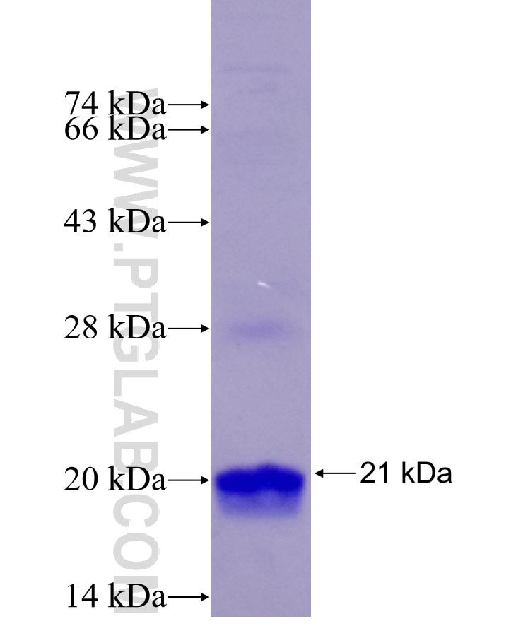 TPH1 fusion protein Ag29473 SDS-PAGE TPH1 fusion protein Ag29473 SDS-PAGE