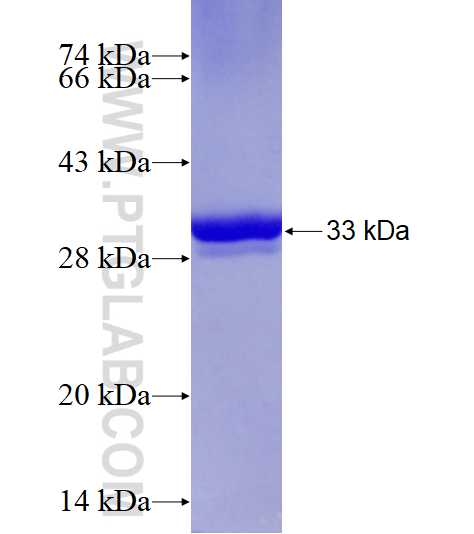 TPH1 fusion protein Ag14978 SDS-PAGE