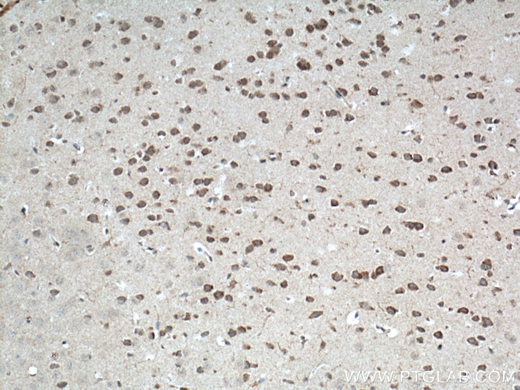 Immunohistochemistry (IHC) staining of mouse brain tissue using TPH2 Polyclonal antibody (22590-1-AP)