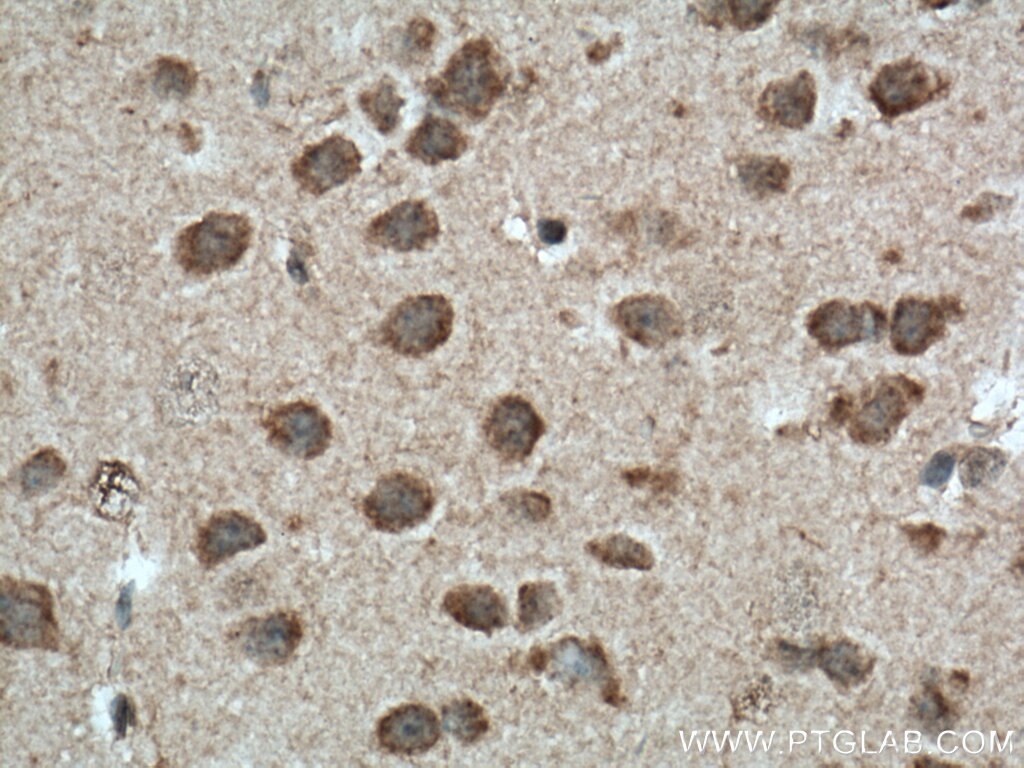 Immunohistochemistry (IHC) staining of mouse brain tissue using TPH2 Polyclonal antibody (22590-1-AP)
