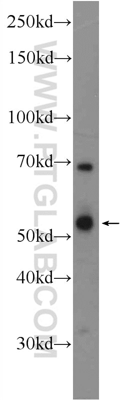 Western Blot (WB) analysis of rat brain tissue using TPH2 Polyclonal antibody (22590-1-AP)