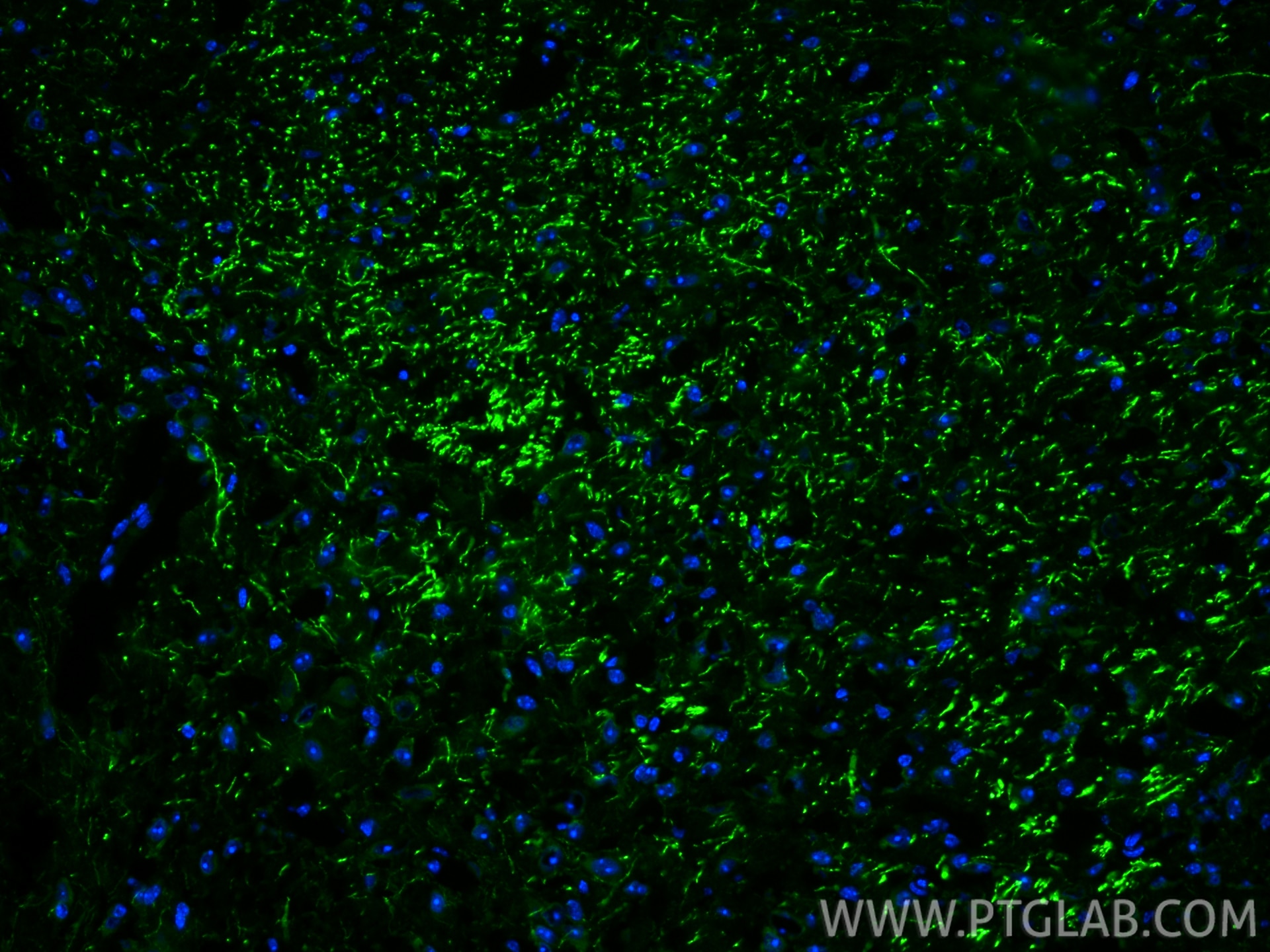 IF Staining of mouse brain using 29283-1-AP Immunofluorescence (IF) / fluorescent staining of mouse brain tissue using TPH2 Polyclonal antibody (29283-1-AP)