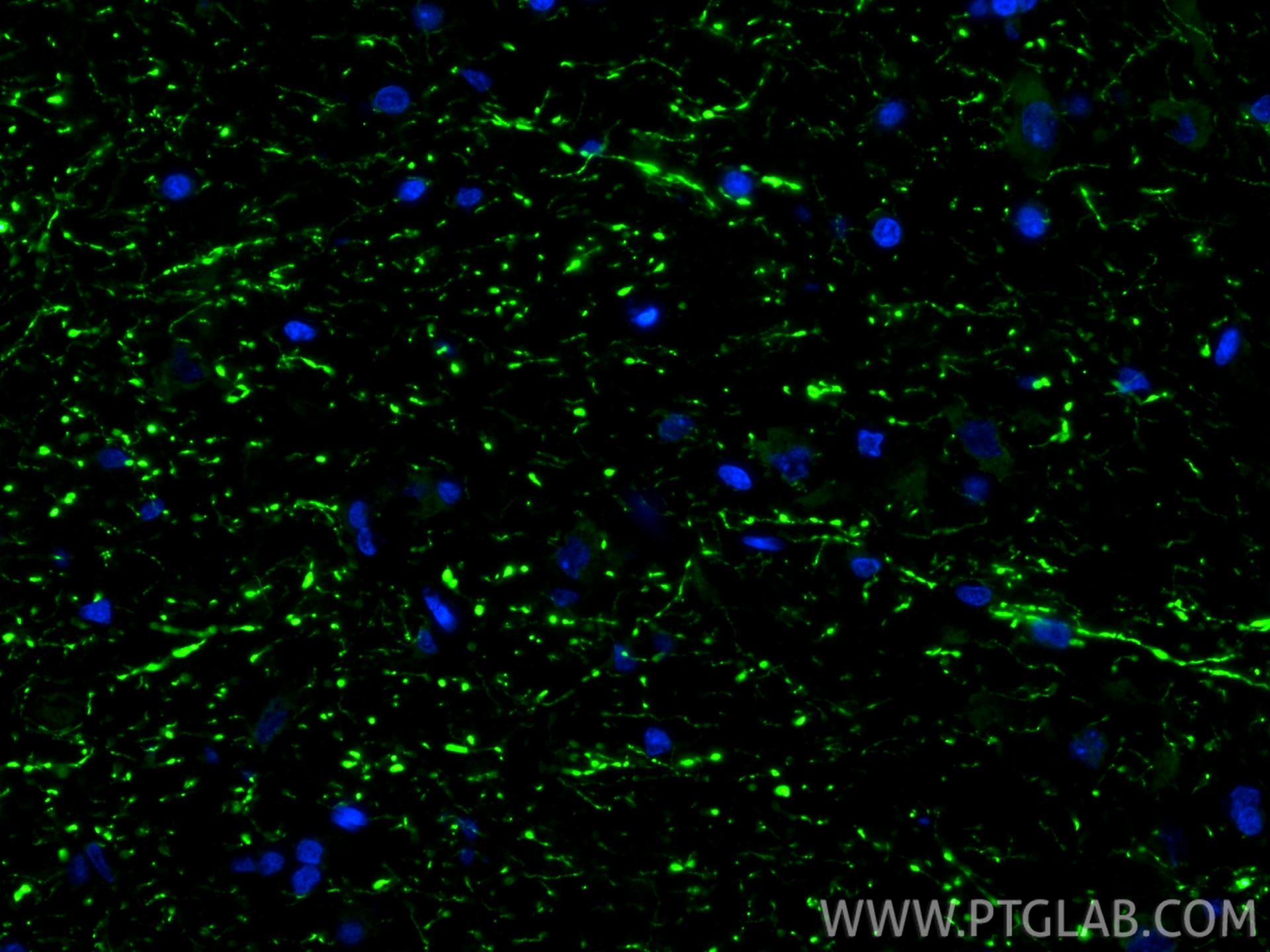 IF Staining of rat brain using 29283-1-AP Immunofluorescence (IF) / fluorescent staining of rat brain tissue using TPH2 Polyclonal antibody (29283-1-AP)