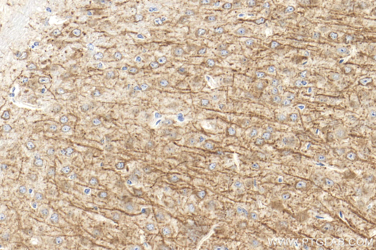 Immunohistochemistry (IHC) staining of mouse brain tissue using TPH2 Polyclonal antibody (29283-1-AP)