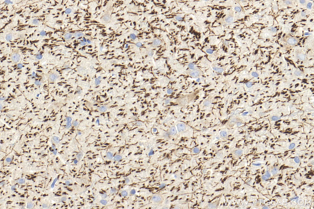 Immunohistochemistry (IHC) staining of rat brain tissue using TPH2 Polyclonal antibody (29283-1-AP)