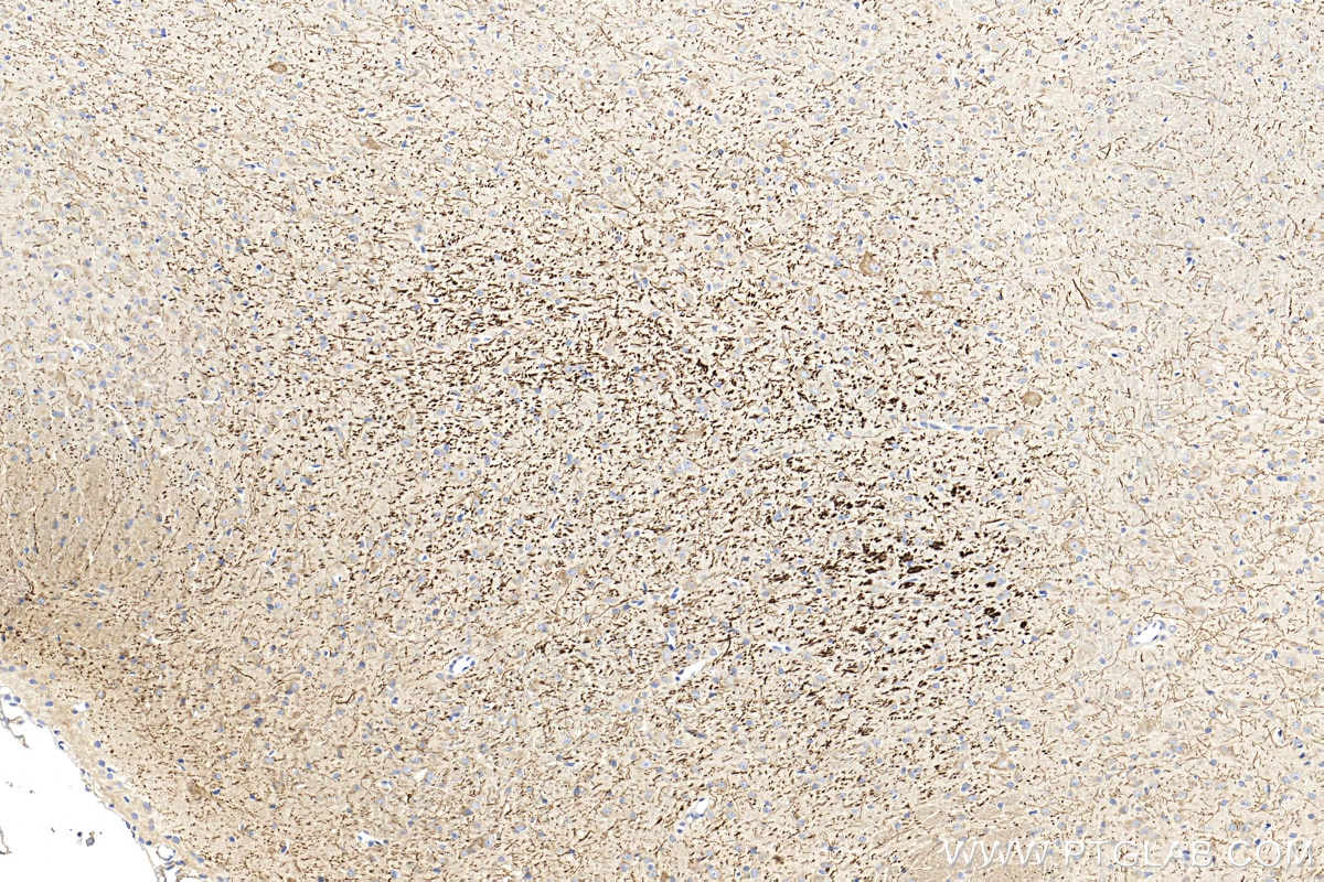 Immunohistochemistry (IHC) staining of rat brain tissue using TPH2 Polyclonal antibody (29283-1-AP)