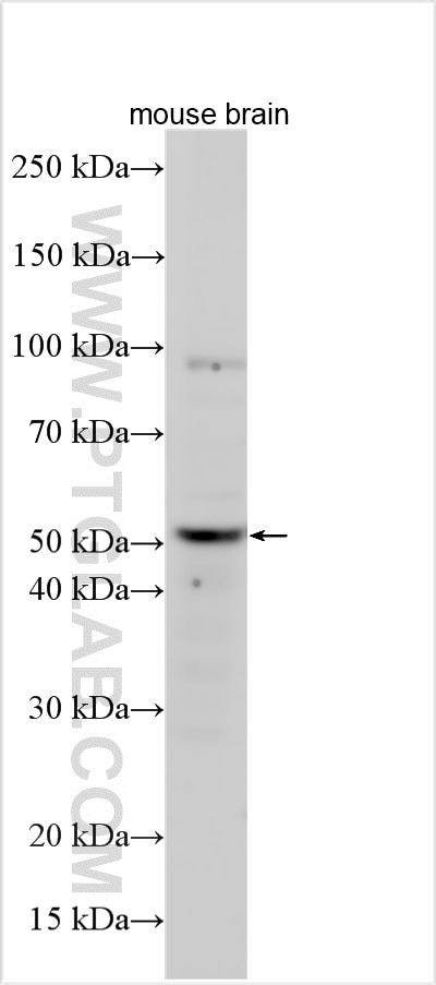Western Blot (WB) analysis of various lysates using TPH2 Polyclonal antibody (29283-1-AP)