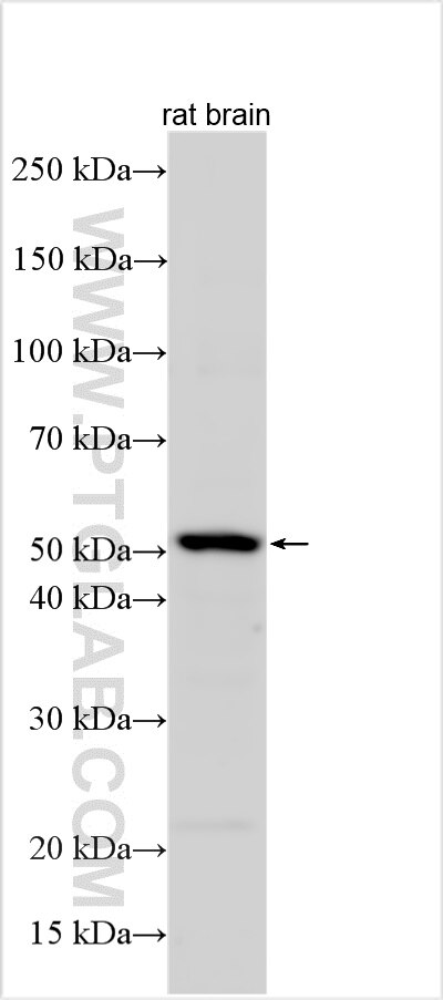 Western Blot (WB) analysis of various lysates using TPH2 Polyclonal antibody (29283-1-AP)