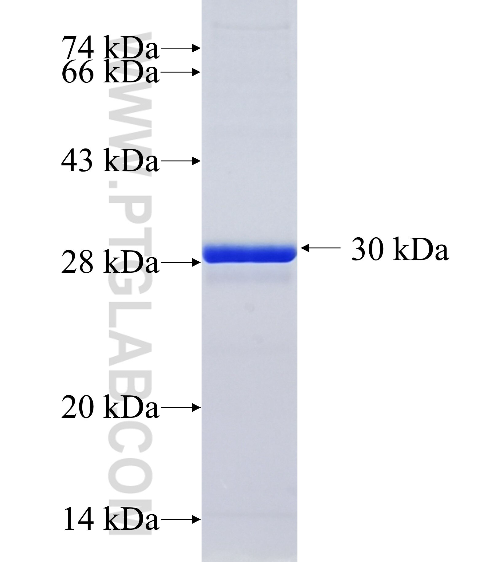 TPH2 fusion protein Ag30281 SDS-PAGE