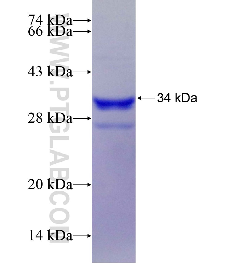 TPH2 fusion protein Ag18408 SDS-PAGE