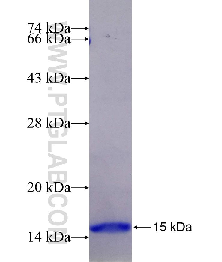 TPH2 fusion protein Ag18518 SDS-PAGE
