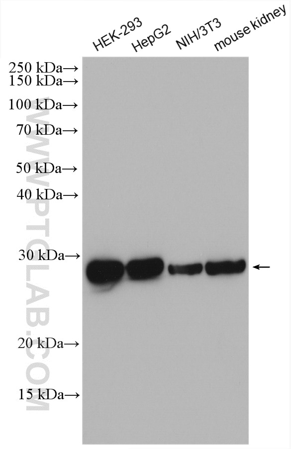 Western Blot (WB) analysis of various lysates using TPI1 Polyclonal antibody (10713-1-AP)
