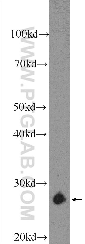 Western Blot (WB) analysis of rat liver tissue using TPI1 Polyclonal antibody (10713-1-AP)