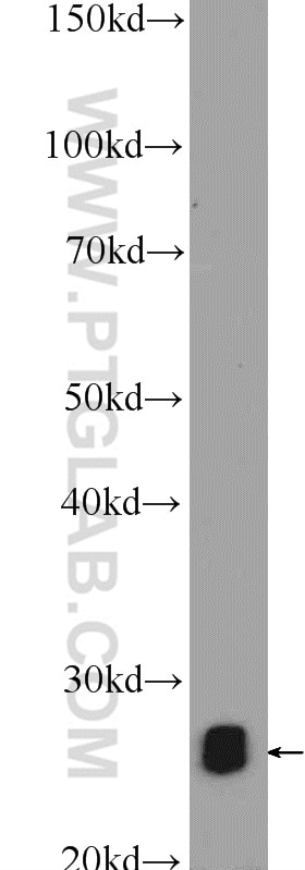 Western Blot (WB) analysis of rat kidney tissue using TPI1 Polyclonal antibody (10713-1-AP)