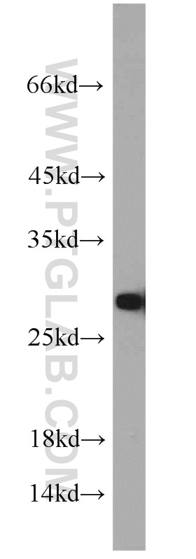 Western Blot (WB) analysis of A431 cells using TPI1 Polyclonal antibody (10713-1-AP)