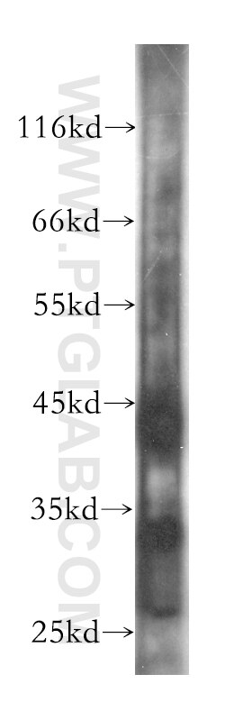 Western Blot (WB) analysis of HeLa cells using TPI1 Monoclonal antibody (60036-1-Ig)
