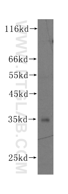 Western Blot (WB) analysis of HeLa cells using TPI1 Monoclonal antibody (60036-2-Ig)