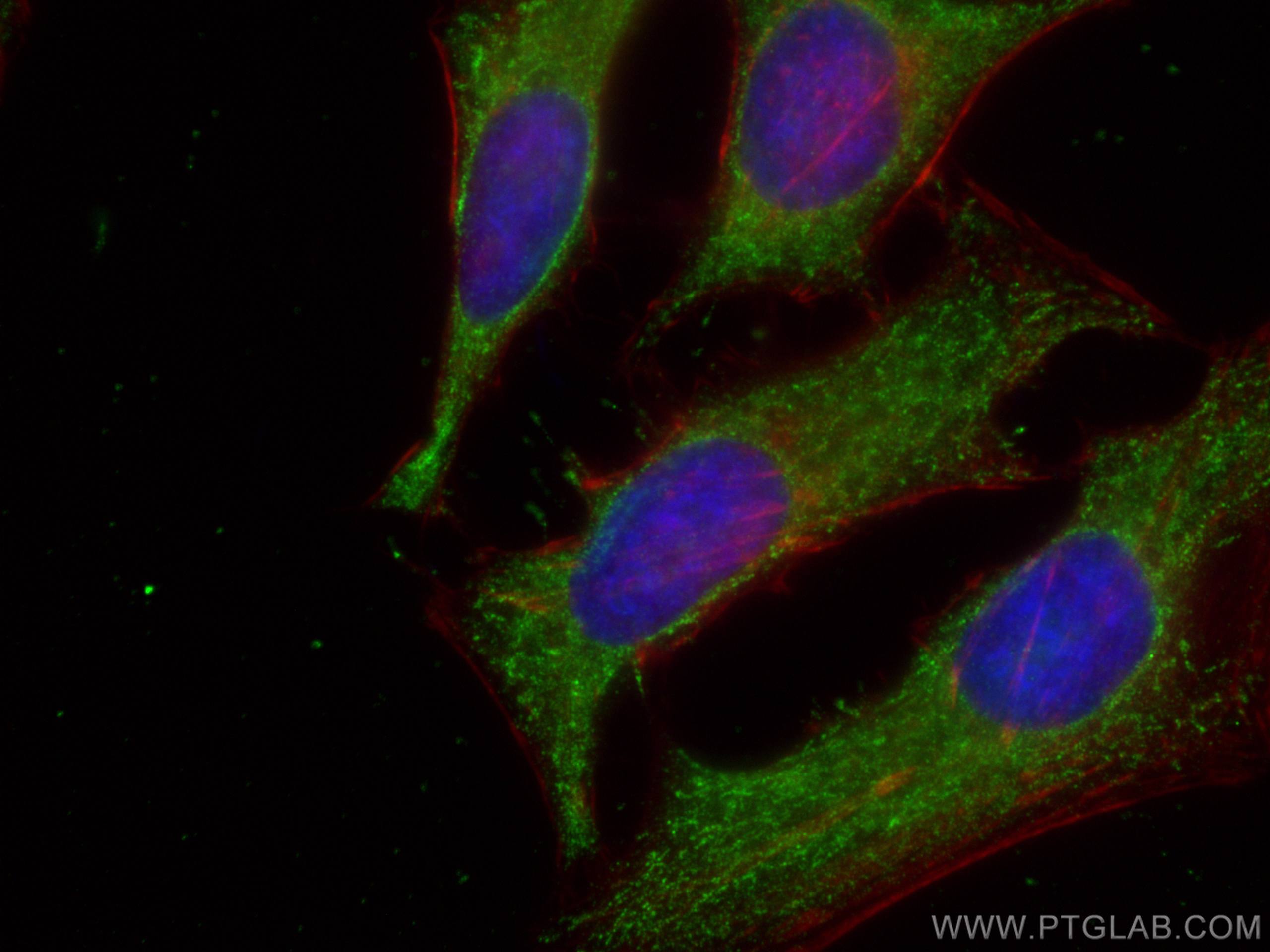 Immunofluorescence (IF) / fluorescent staining of HeLa cells using TPI1 Monoclonal antibody (67515-1-Ig)