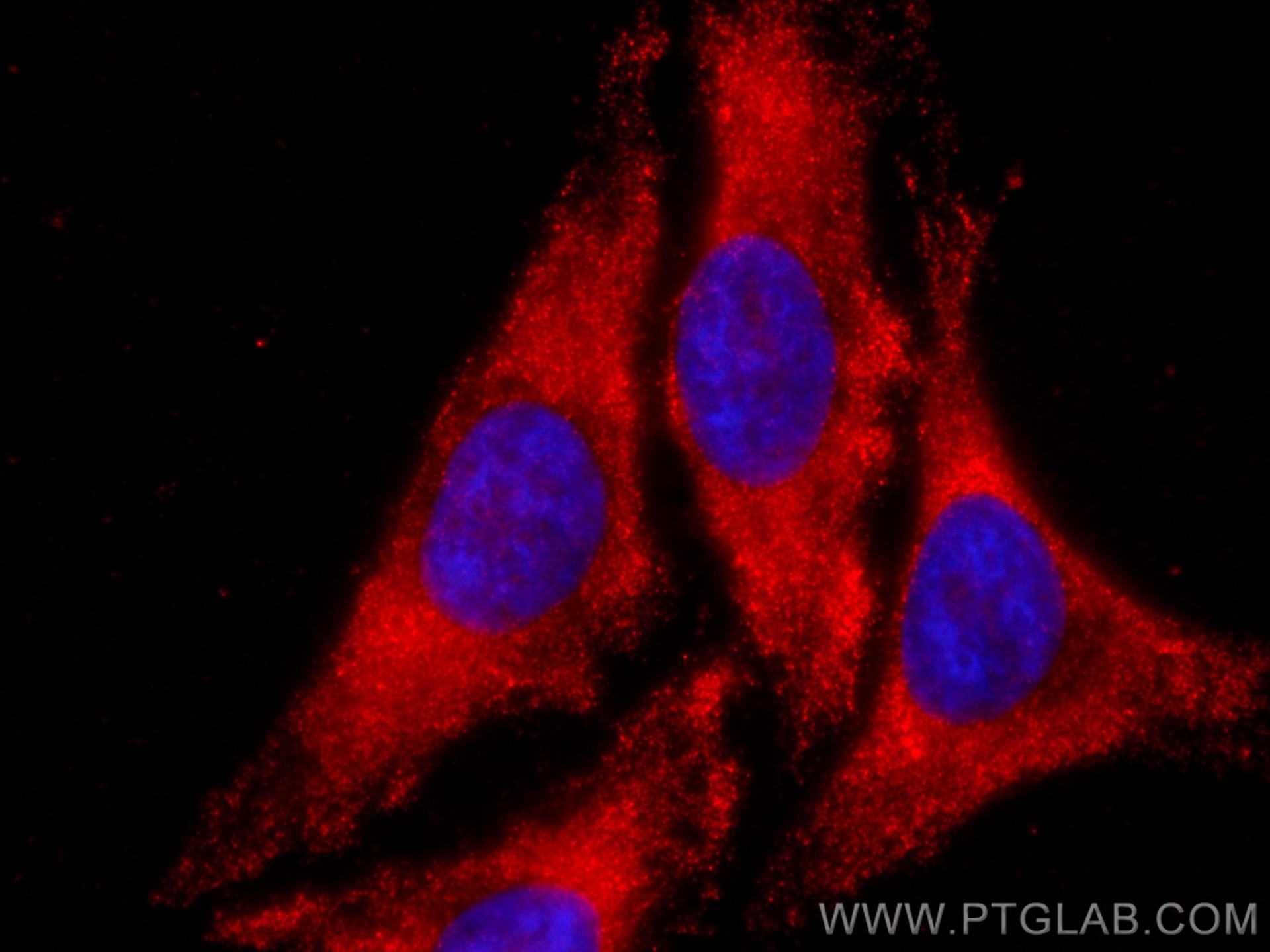 Immunofluorescence (IF) / fluorescent staining of HeLa cells using CoraLite®594-conjugated TPI1 Monoclonal antibody (CL594-67515)