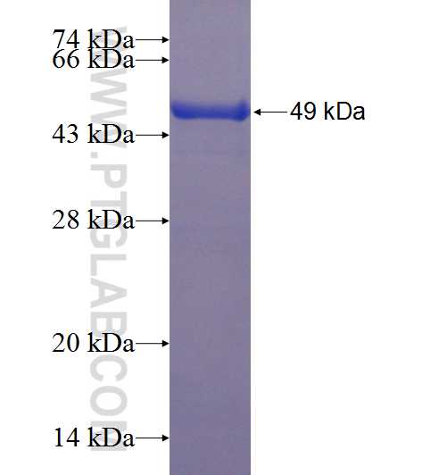TPI1 fusion protein Ag1175 SDS-PAGE