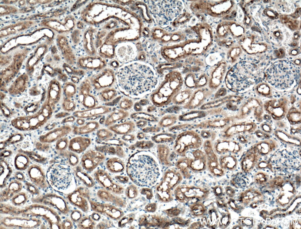 Immunohistochemistry (IHC) staining of human kidney tissue using TPK1 Polyclonal antibody (10942-1-AP)